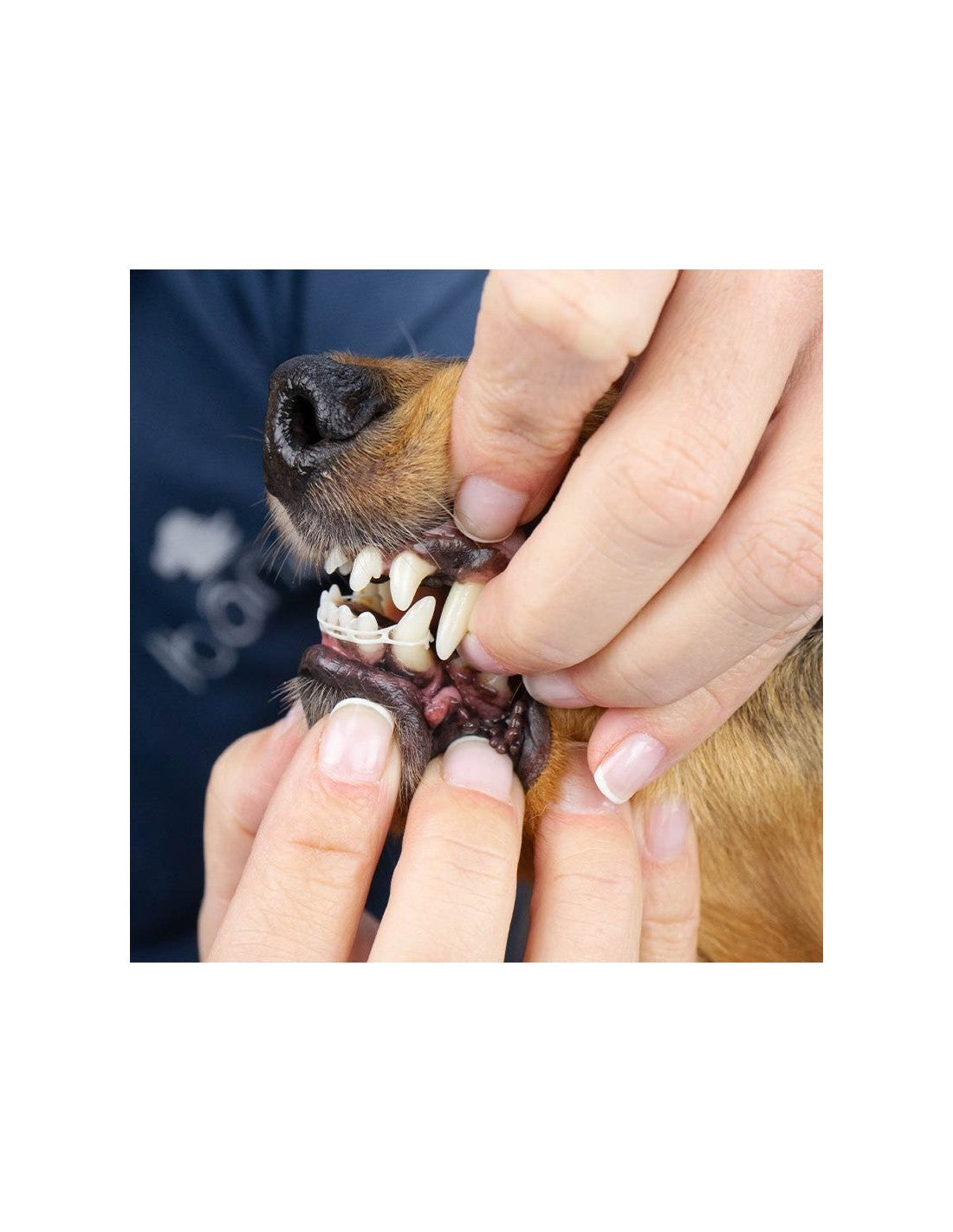 Elastique pour correction du positionnement des dents – photo 2