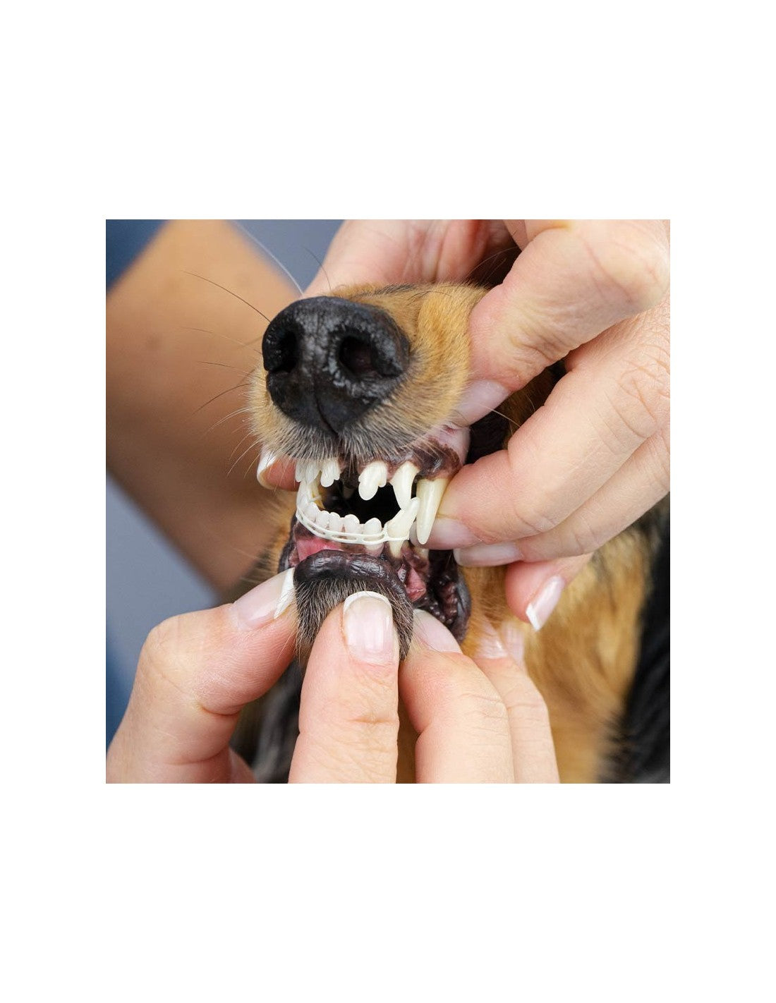 Elastique pour correction du positionnement des dents – photo 3